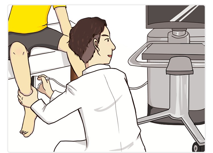 下肢静脈瘤の超音波エコー検査