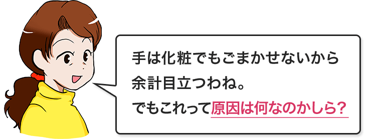 手は化粧でもごまかせないから余計目立つわね。でもこれって原因は何なのかしら?