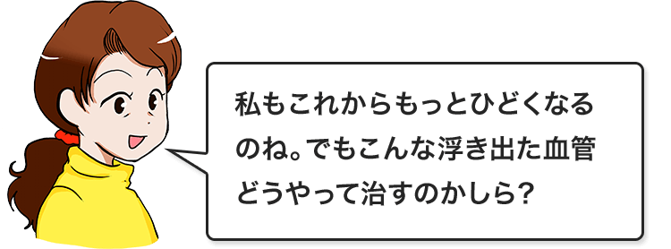 私もこれからもっとひどくなるのね。でもこんな浮き出た血管どうやって治すのかしら