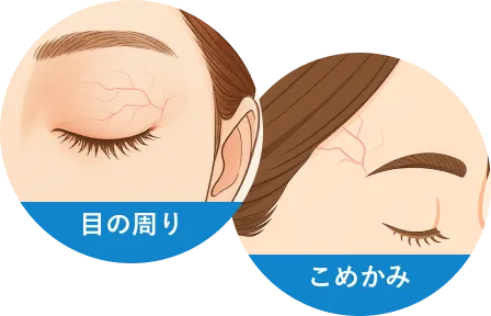 目の周り・こめかみ