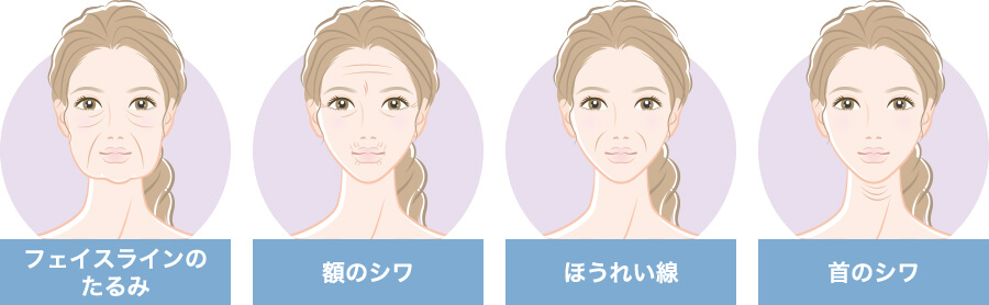 フェイスラインのたるみ。顎のシワ。ほうれい線。首のシワ