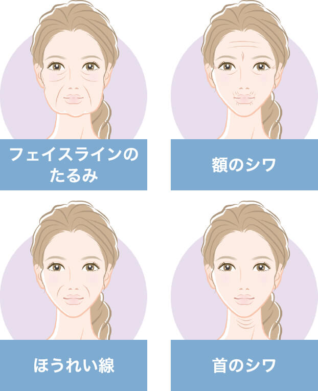 フェイスラインのたるみ。顎のシワ。ほうれい線。首のシワ