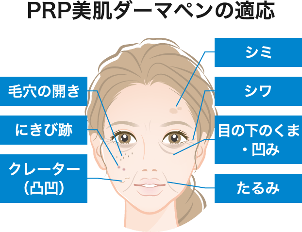 PRP美肌ダーマペンの適応