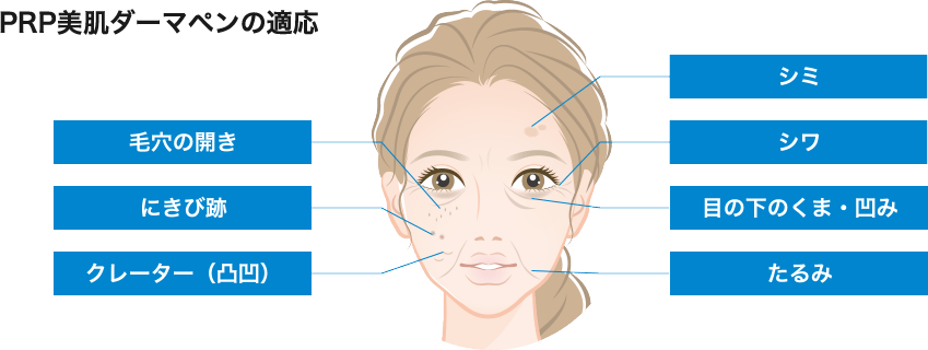 PRP美肌ダーマペンの適応