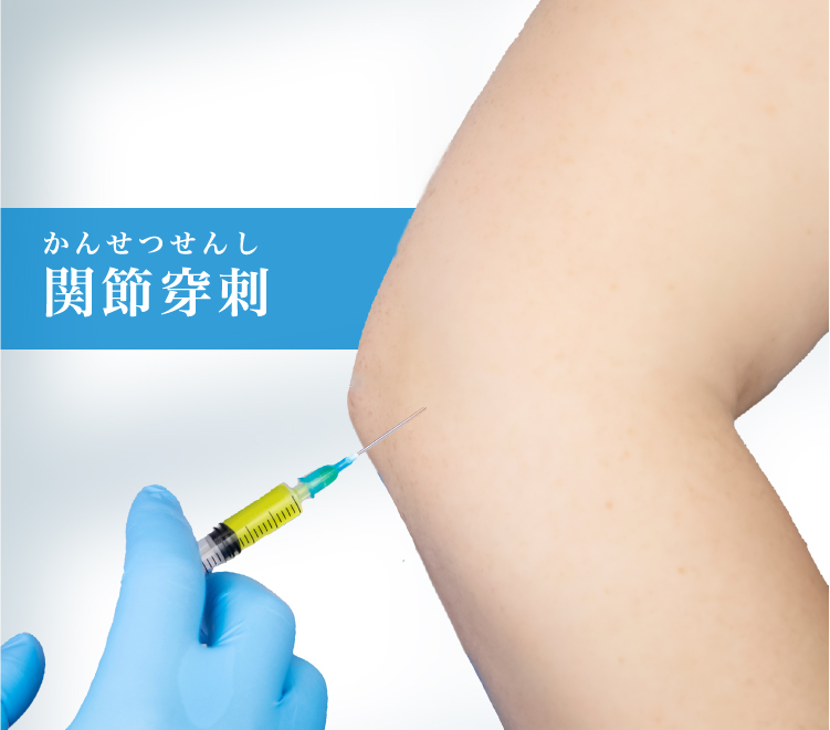 関節穿刺