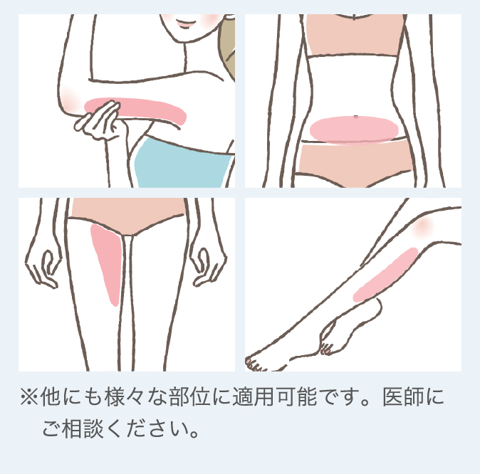 お体の適応部位