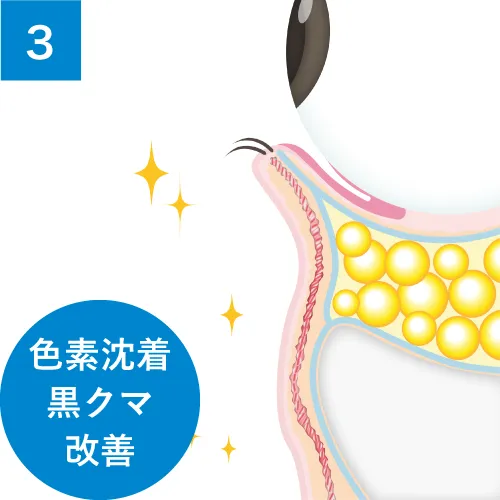 ふくらみだけでなく、凹みや色素沈着も同時に改善