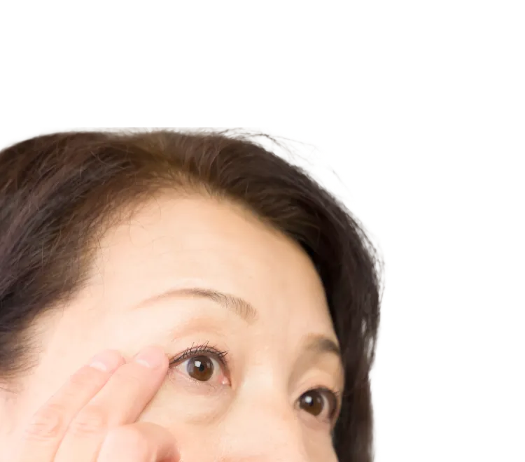 老け顔に見られる目の下のふくらみを取り除いてハリのある若々しい目元に。PRP下眼瞼脱脂術