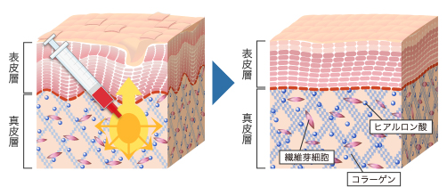 ご自分の肌が再生するから効果が長期に持続