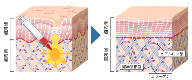 ご自分の肌が再生するから効果が長期に持続