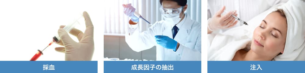 若返りPRP注射とは