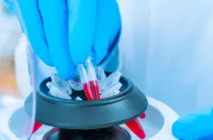 PRPの作製(10分程度)