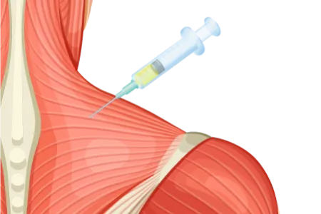 PRPハイドロリリース