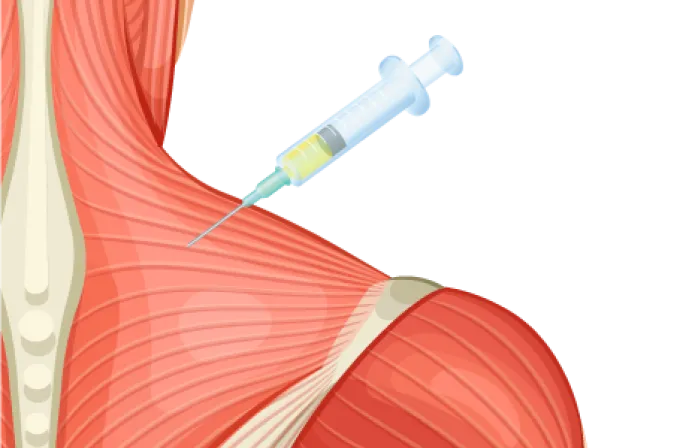 PRPハイドロリリース