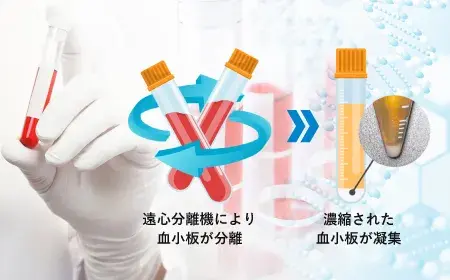 高濃度PRPによる効果の長期間持続