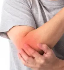 テニス肘・ゴルフ肘