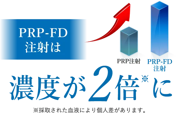 PRP-FD注射は濃度が２倍に