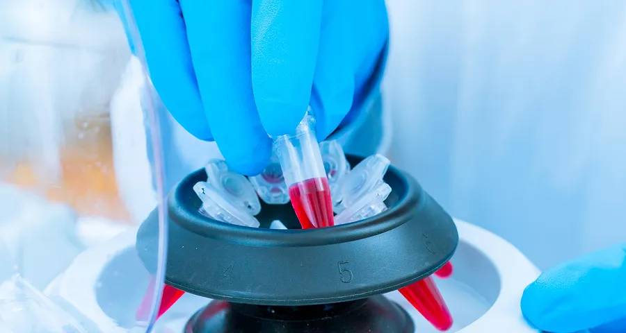 費用がリーズナブル