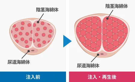 勃起力増大効果