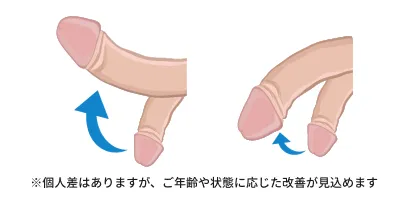 ※個人差はありますが、ご年齢や状態に応じた改善が見込めます