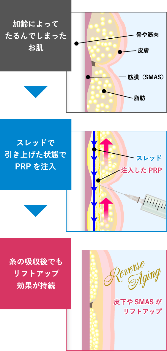 長期間リフトアップ＆美肌波及効果