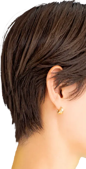 PRPG注入治療による後頭部形成術後頭部のへこみ（絶壁）を解消し美しい横顔に