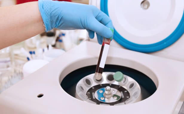 3. PRP作製（20分程度）