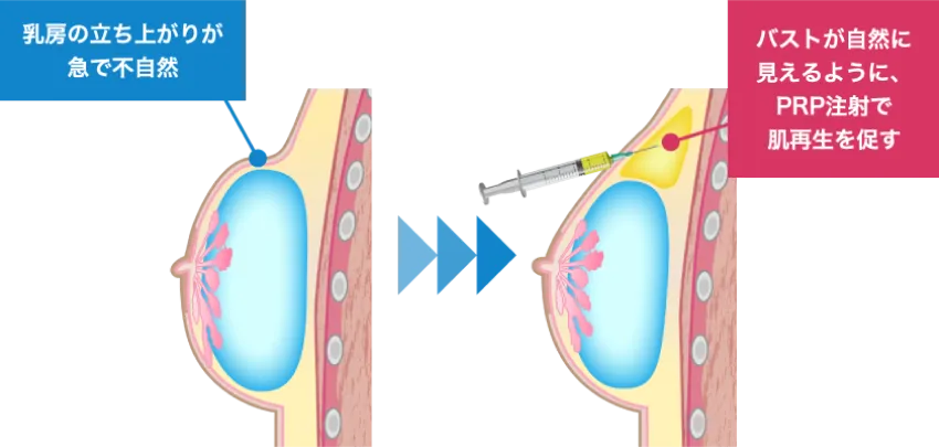 症状が重い場合は、数回繰り返し行うことにより、問題を改善していくことができます。
