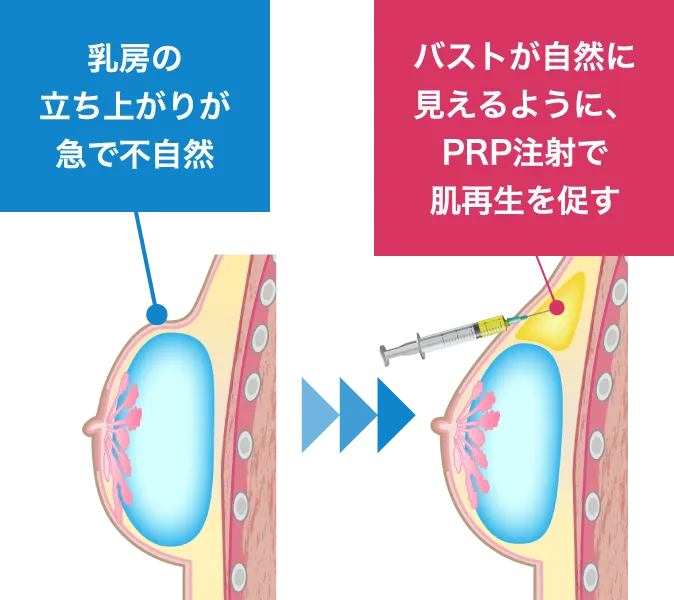 症状が重い場合は、数回繰り返し行うことにより、問題を改善していくことができます。