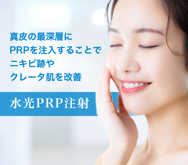 真皮の最深層にPRPを注入することでニキビ跡やクレータ肌を改善 水光PRP注射
