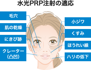 PRP美肌ダーマペンの適応
