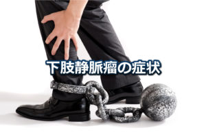 下肢静脈瘤の症状はコブができるだけではない？見た目と見た目以外に起こる症状について