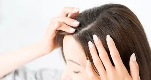 w-スカルプ[薄毛治療]